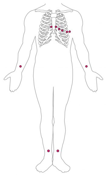 Chapter 19 The Cardiovascular System: The Heart – Anatomy and ...