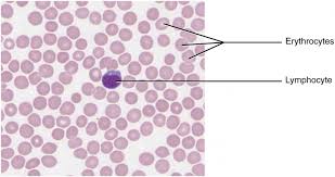 Smear of blood showing cells.