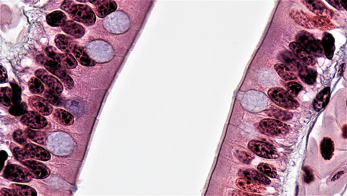 Section of intestine showing columnar cells interspersed with goblet cells.