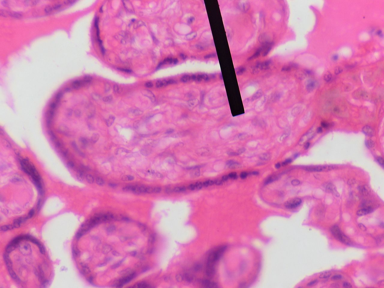 Micrograph showing mesenchymal tissue