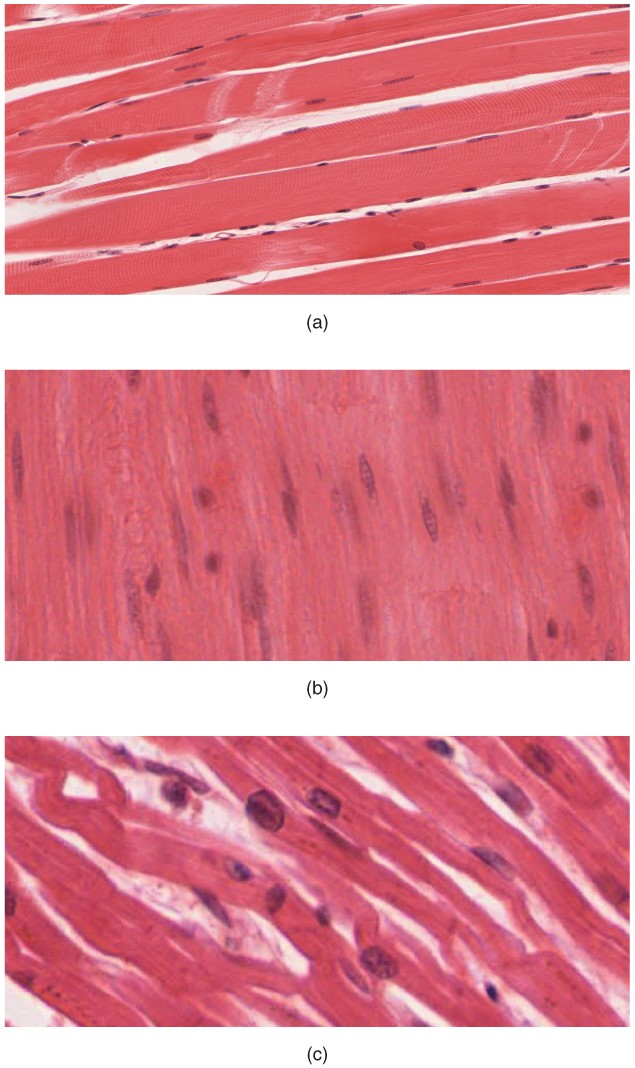 Three images showing skeletal muscle at the top, smooth muscle in the middle, and cardiac muscle at the bottom
