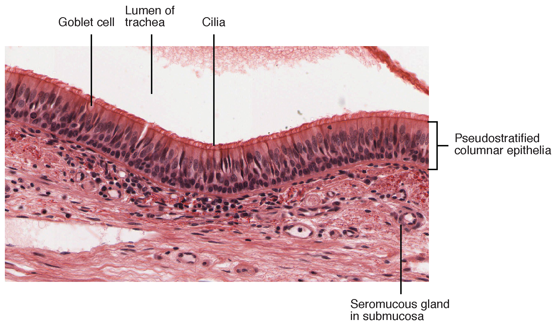 This section shows epithelial tissues that are pseudostratified. Epithelial cells appear to be in layers. But in actual fact, they are not.