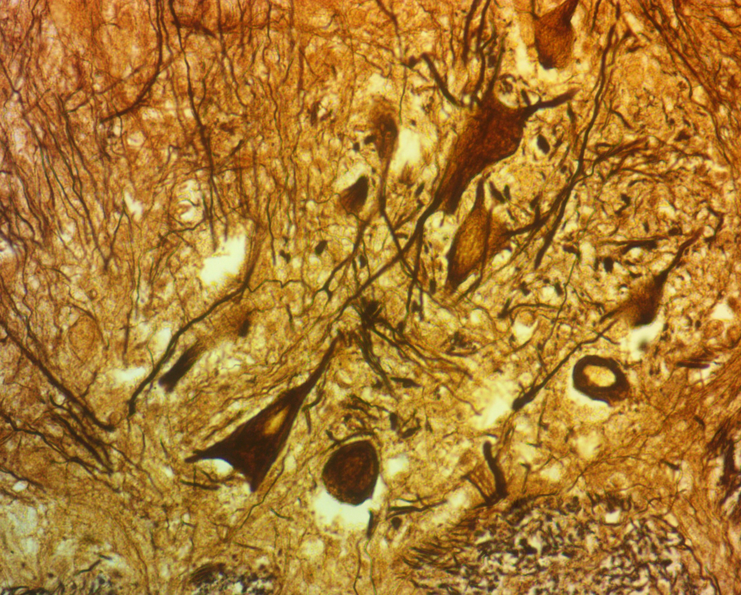 Smear of tissue showing nerve cells.