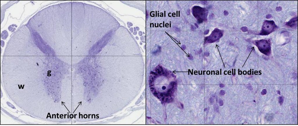 Two panels with left showing a low magnification image of the cross section of spinal cord with gray and white matter and the right panel showing high magnification wiht neurons and glial cells