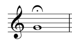 A note in treble clef with a fermata over it.
