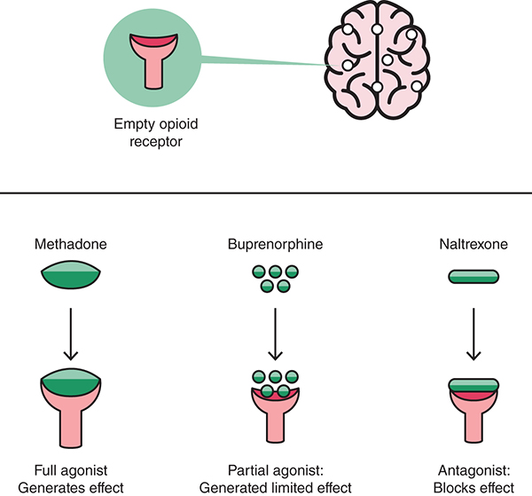 The impact of medication-assisted treatments on the opioid receptors in the brain.